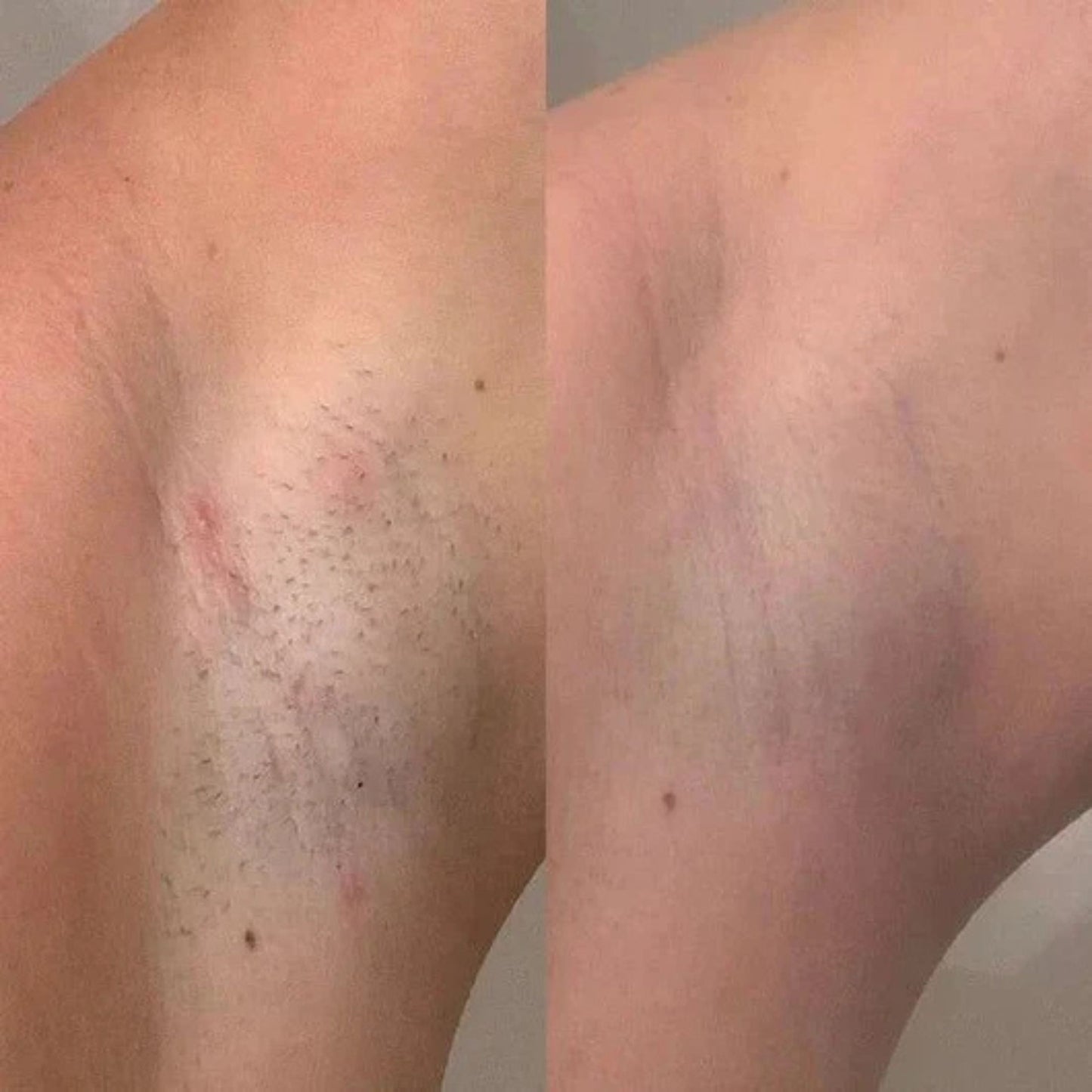 Cyperus Rotundus Oil