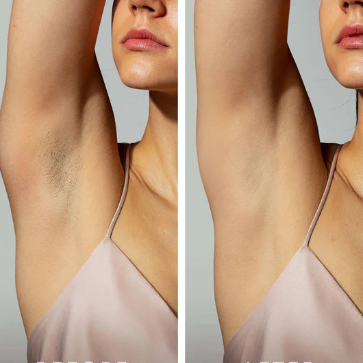 Cyperus Rotundus Oil