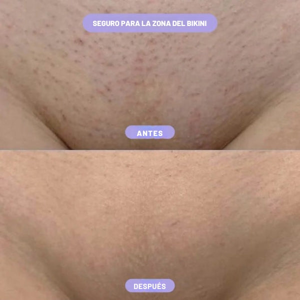 Bikini Hair Cream