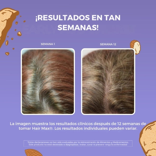 Hair Max