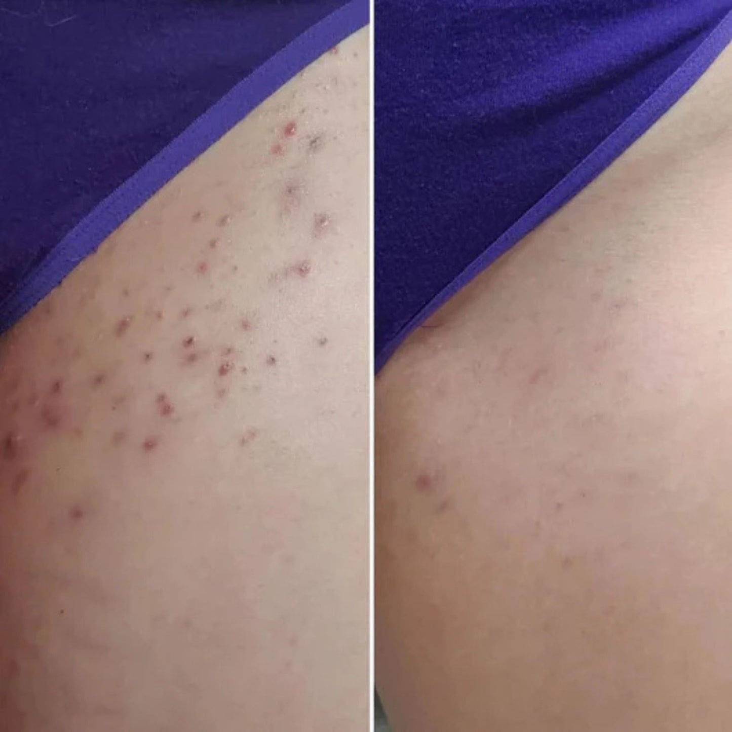 Cyperus Rotundus Oil