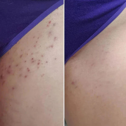 Cyperus Rotundus Oil