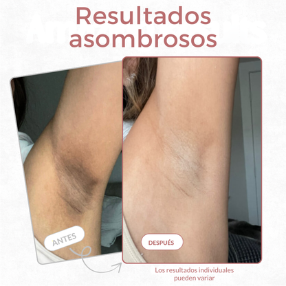 Spray exfoliante corporal - Kójico + Cúrcuma