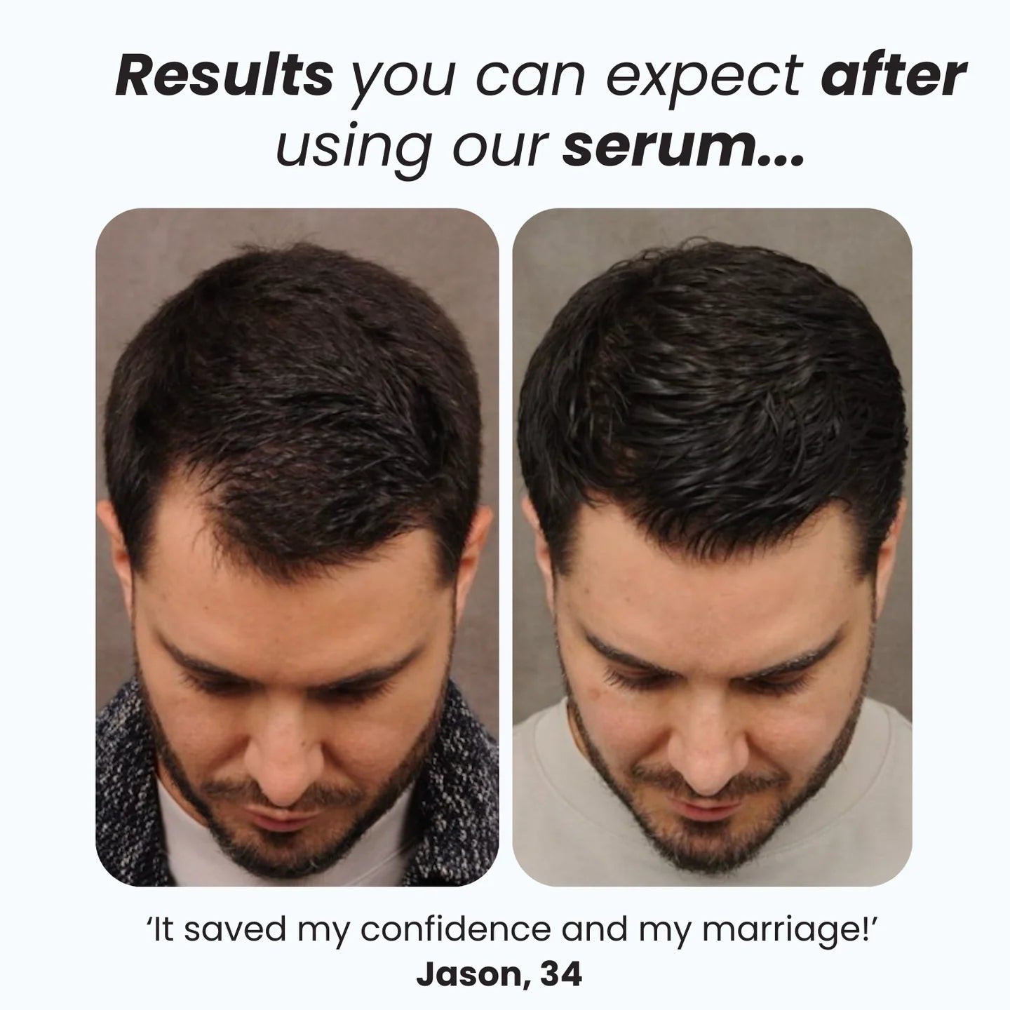 Serum Roll On